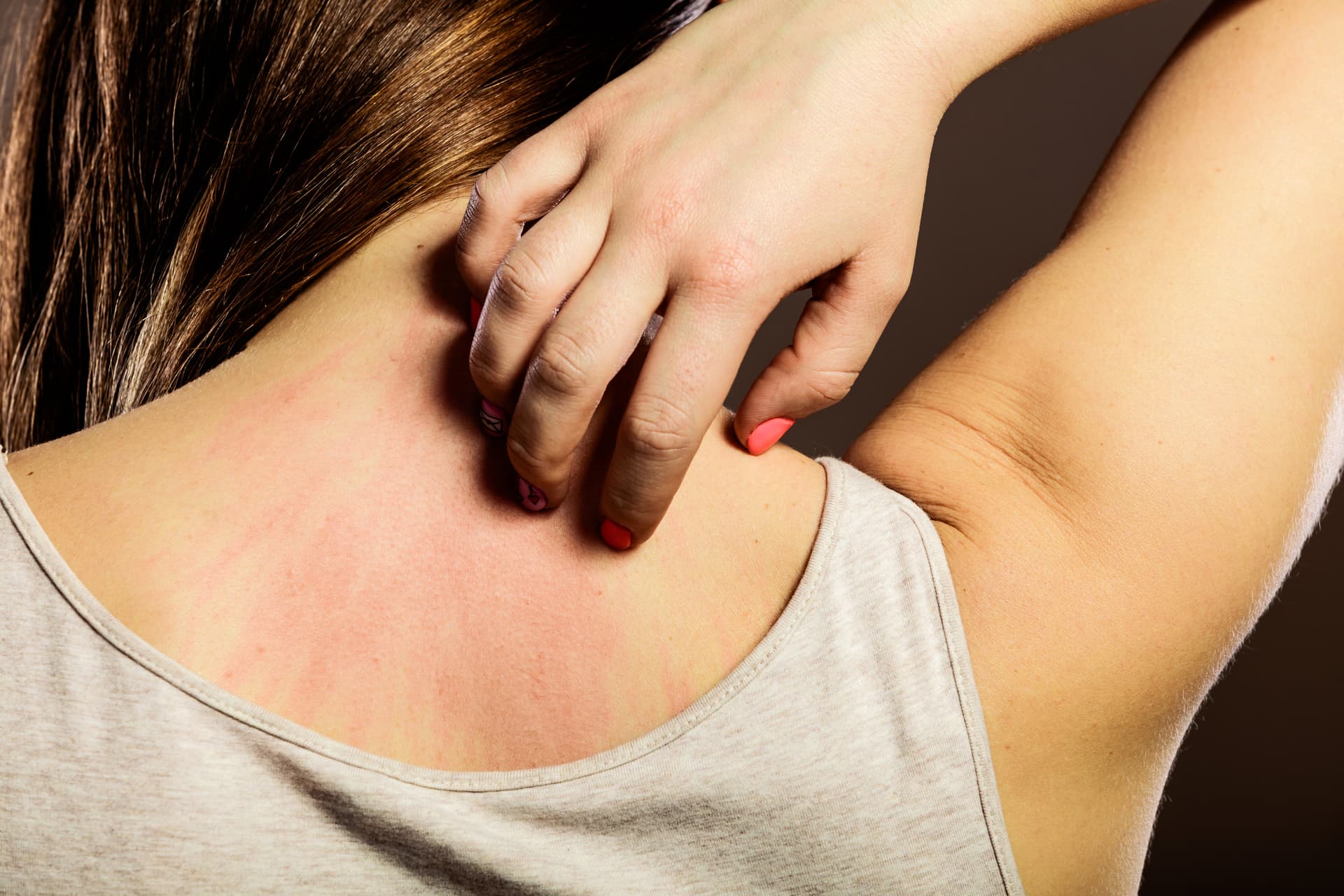 Allgemeine Dermatologie